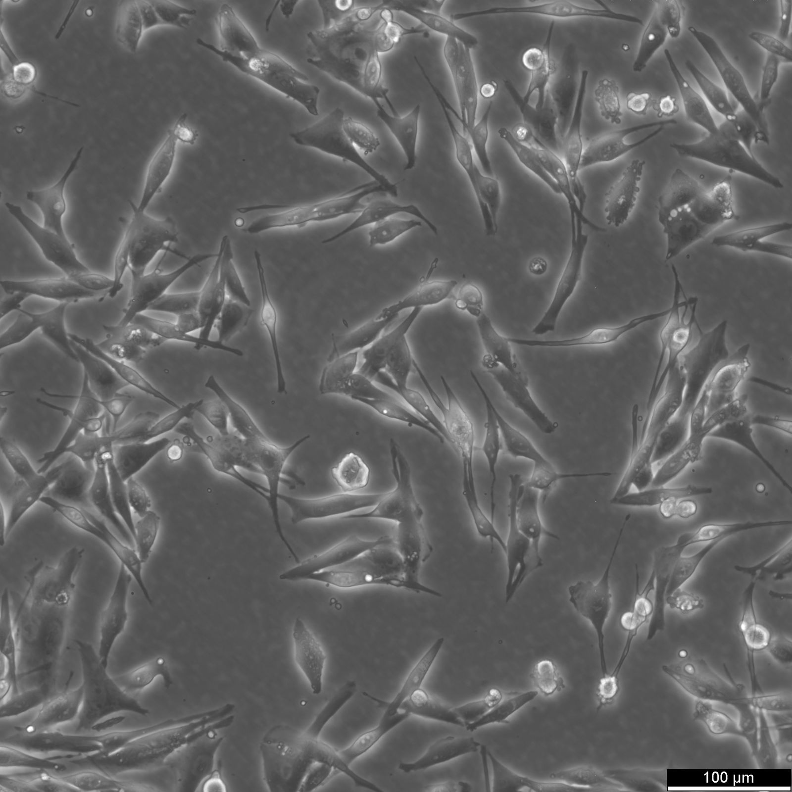 MeWo Cells MeWo Cells