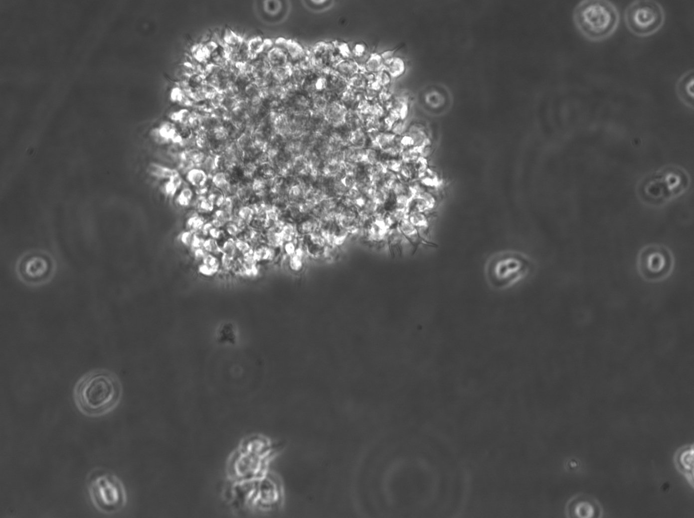 B-LCL-HROC195-Zellen
