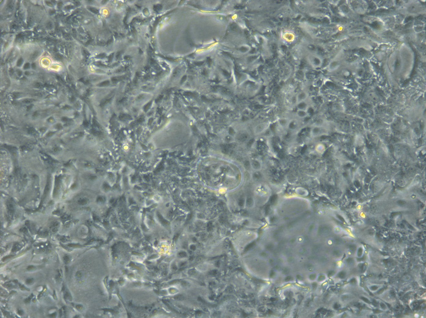 HROC285 T0 M2-Zellen