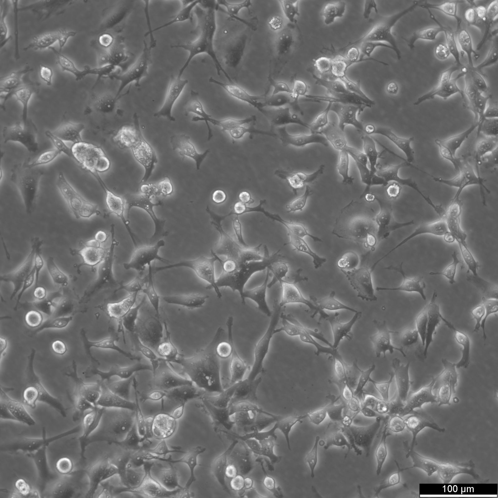 MDA-MB-436 Cells MDA-MB-436 Cells