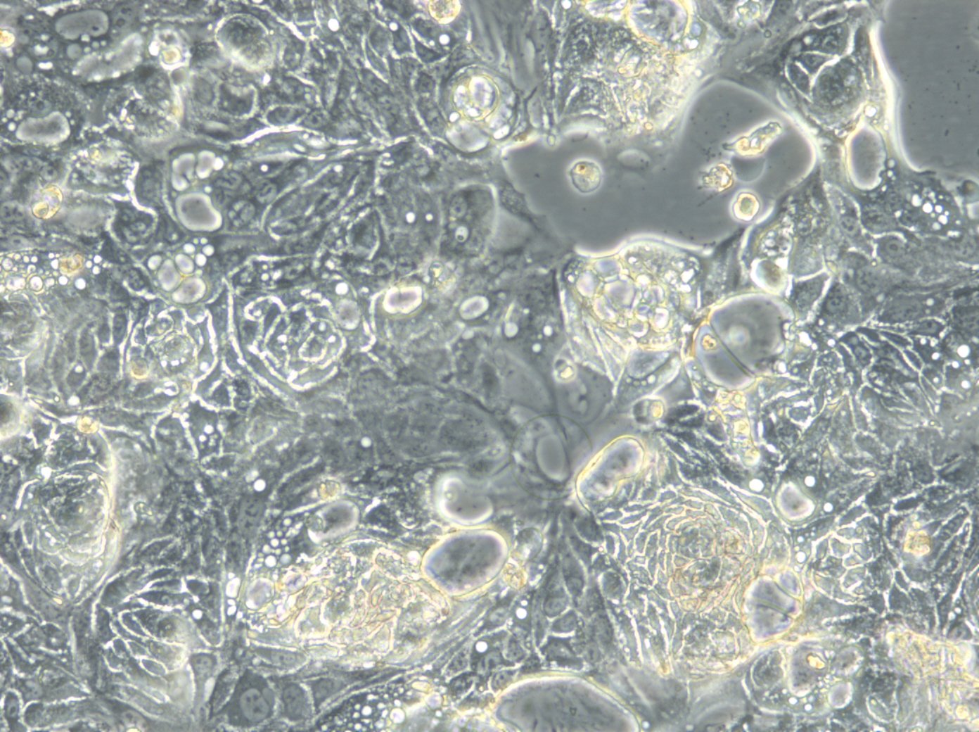 Cellules HROC32 T3 M1