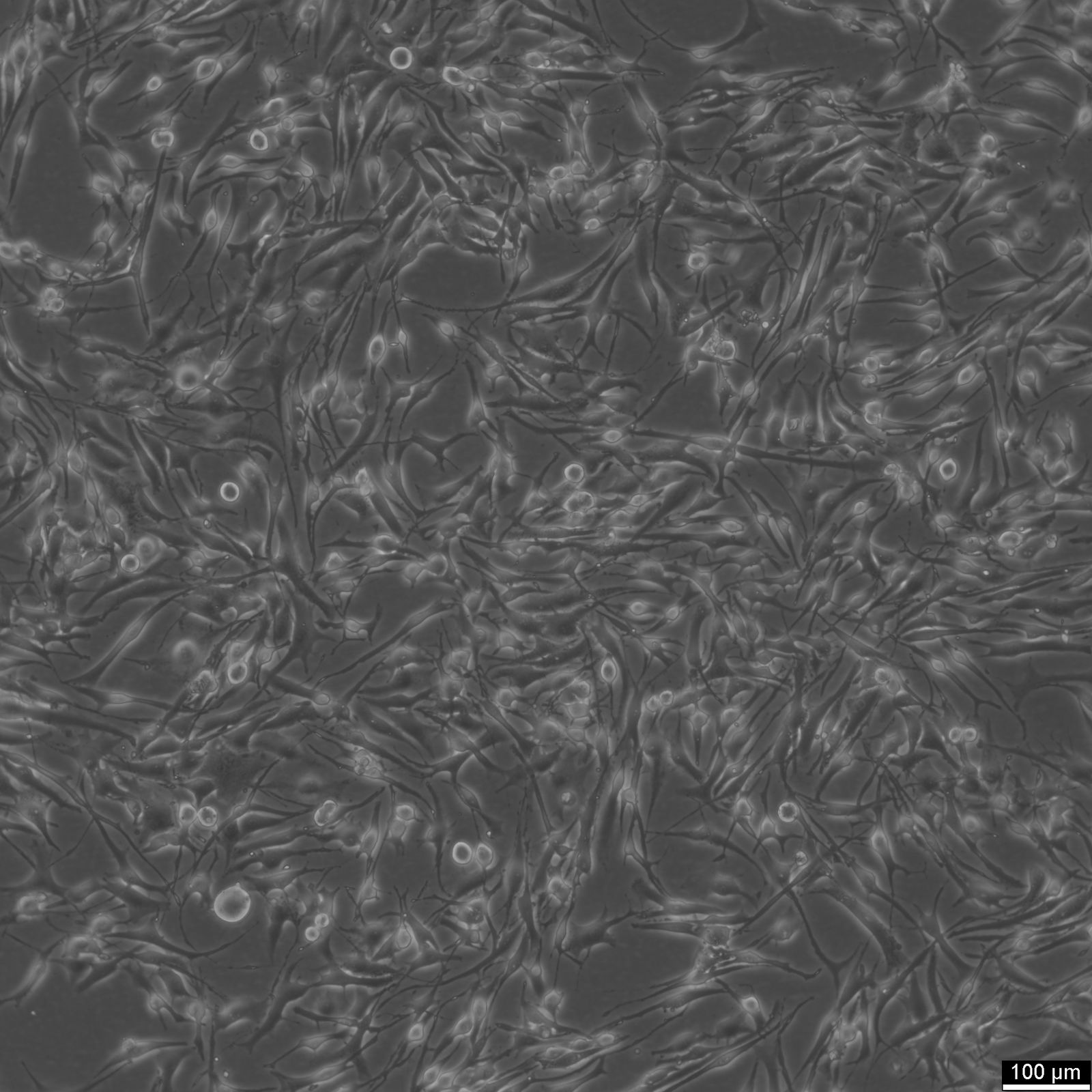 SK-MEL-28-Zellen SK-MEL-28-Zellen