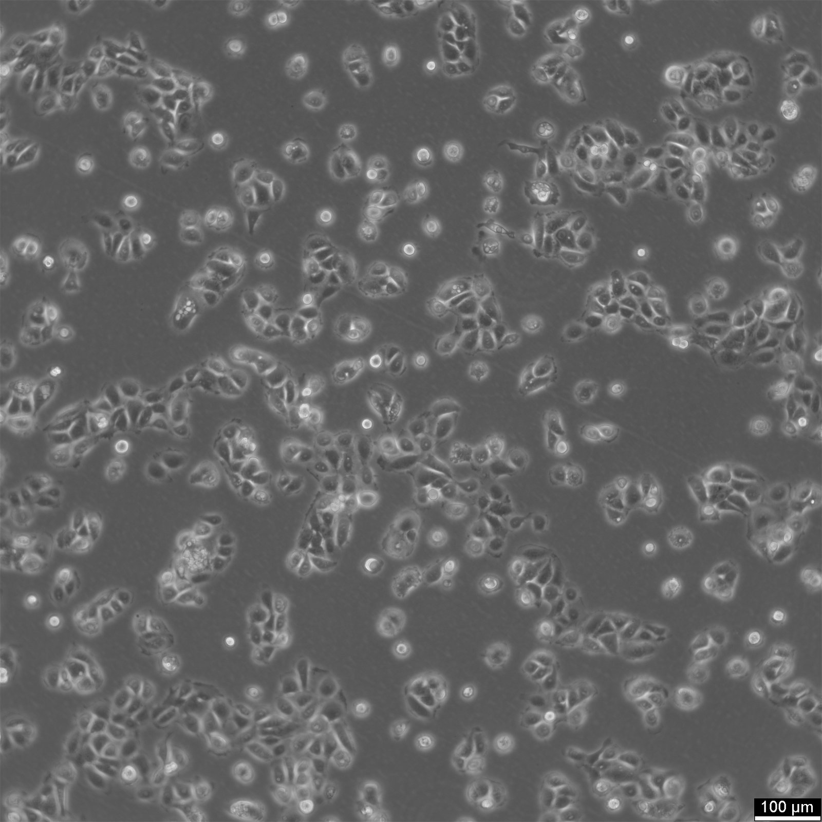 NCI-H292-Zellen