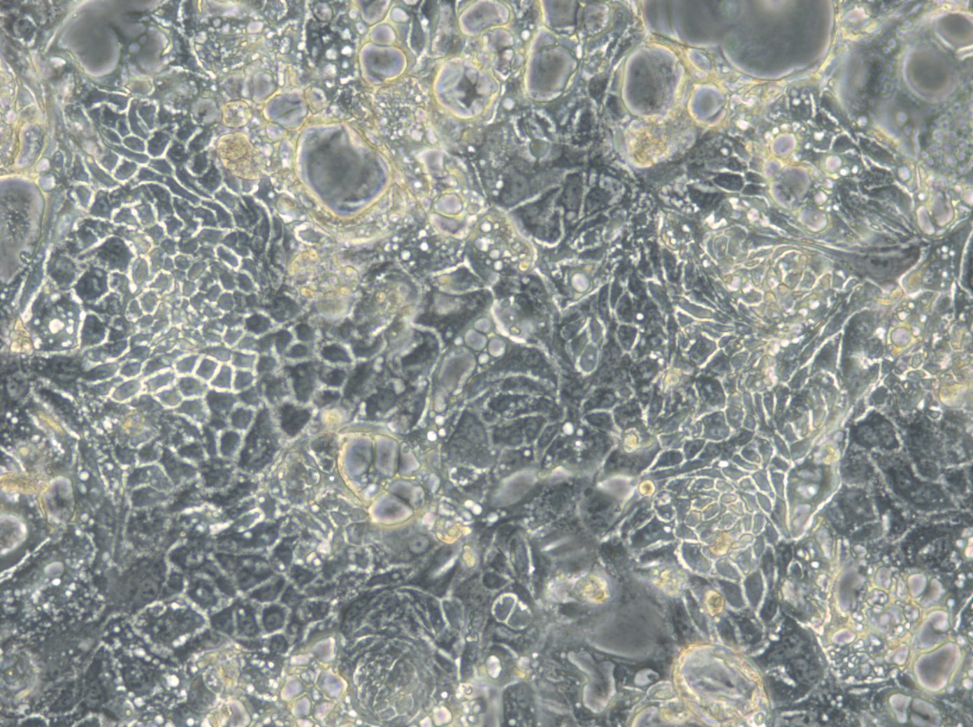 HROC32 T3 M1 Cells