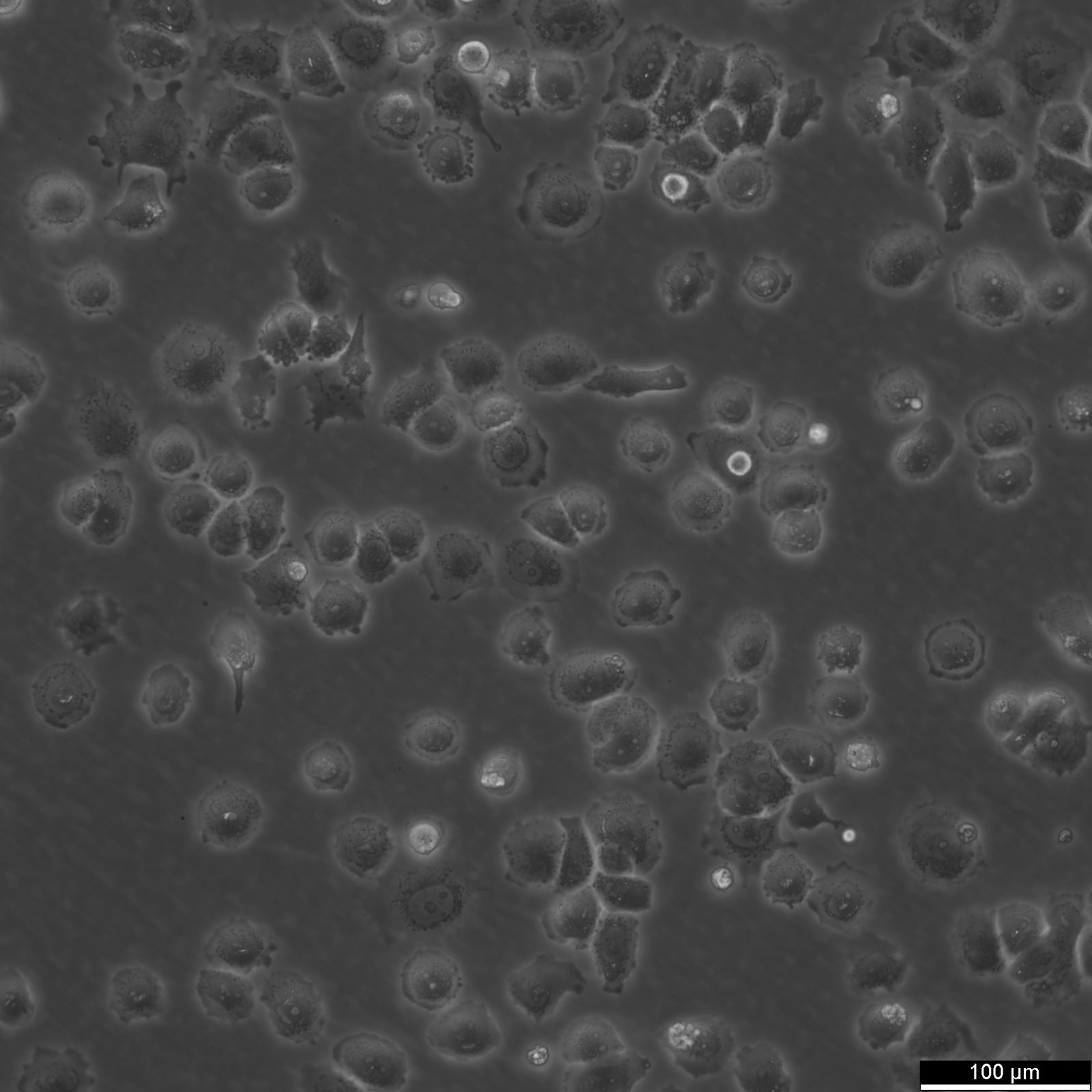 SW-13 Cells SW-13 Cells