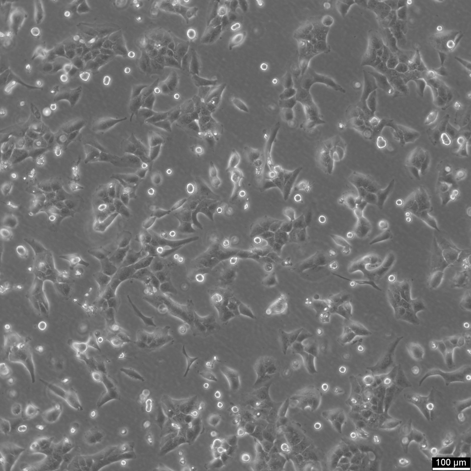 NCI-H2228 Cells NCI-H2228 Cells