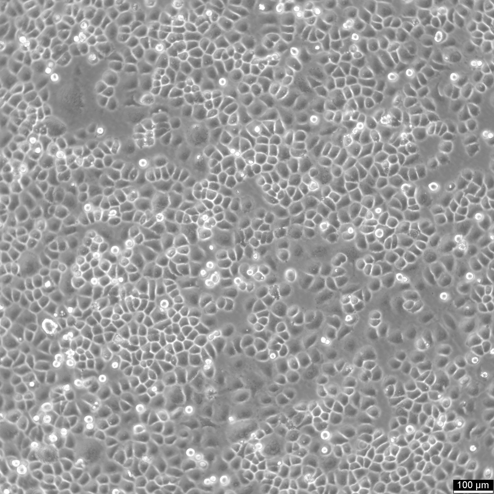 SW-13 Cells SW-13 Cells