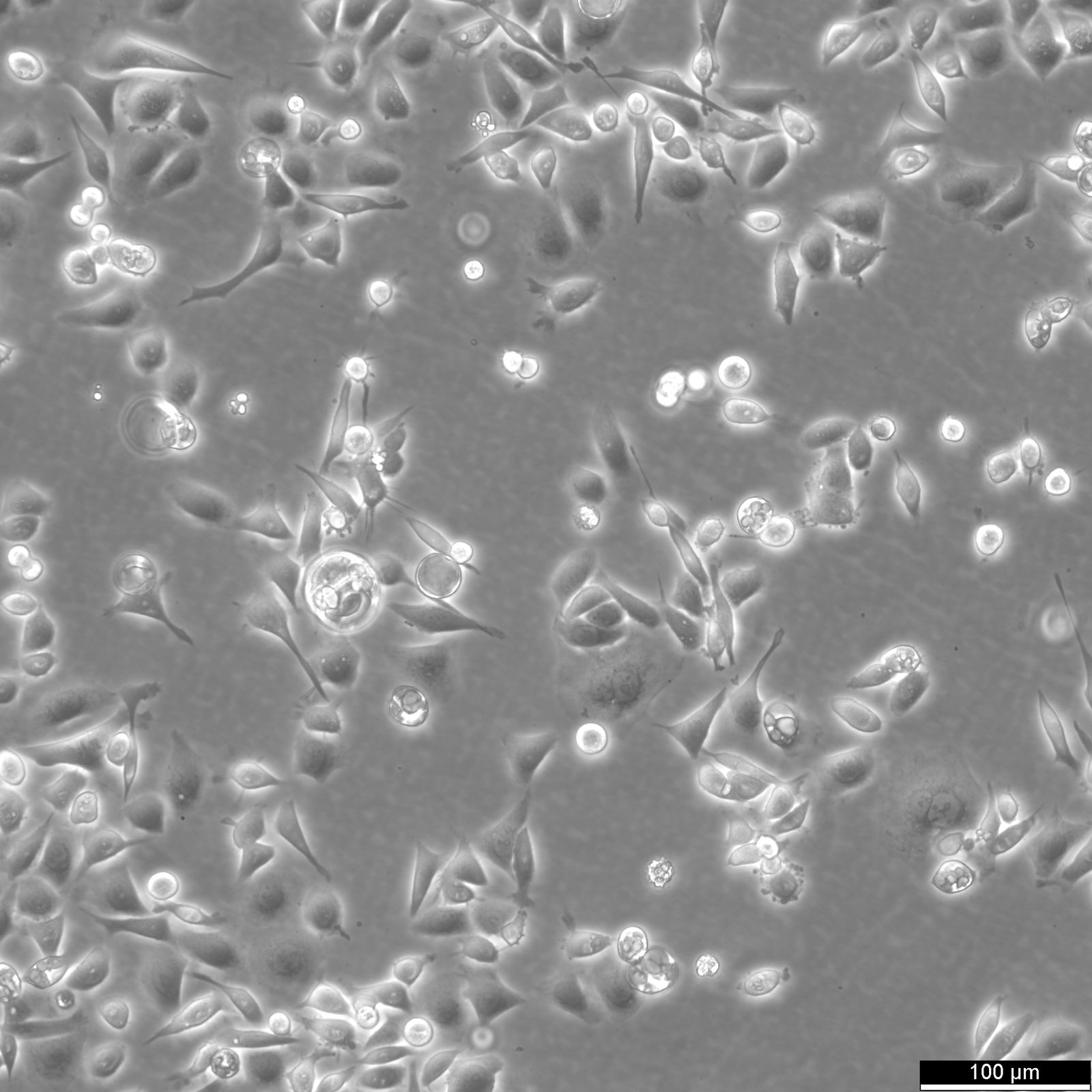 AGS Cells