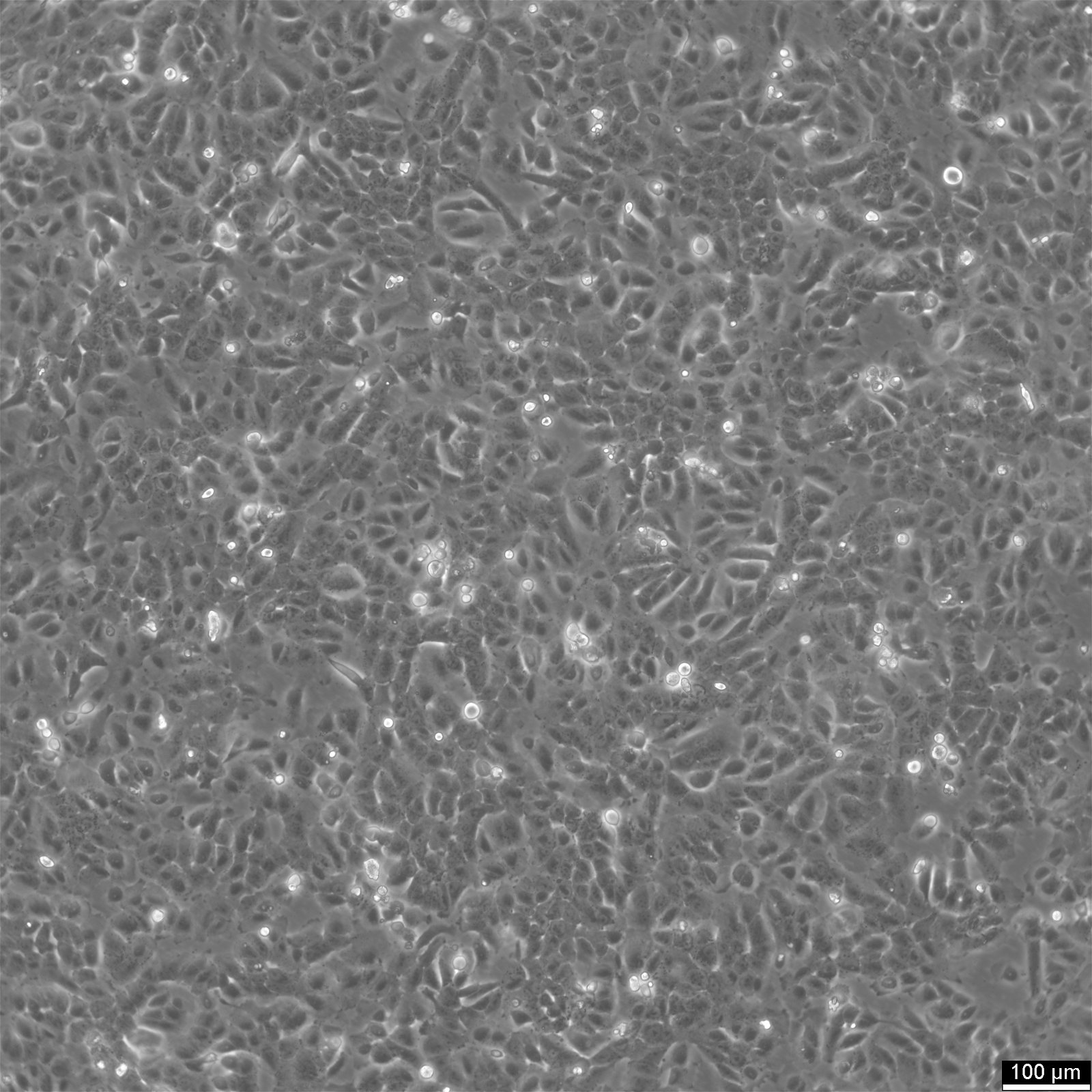 SUM149PT-Zellen