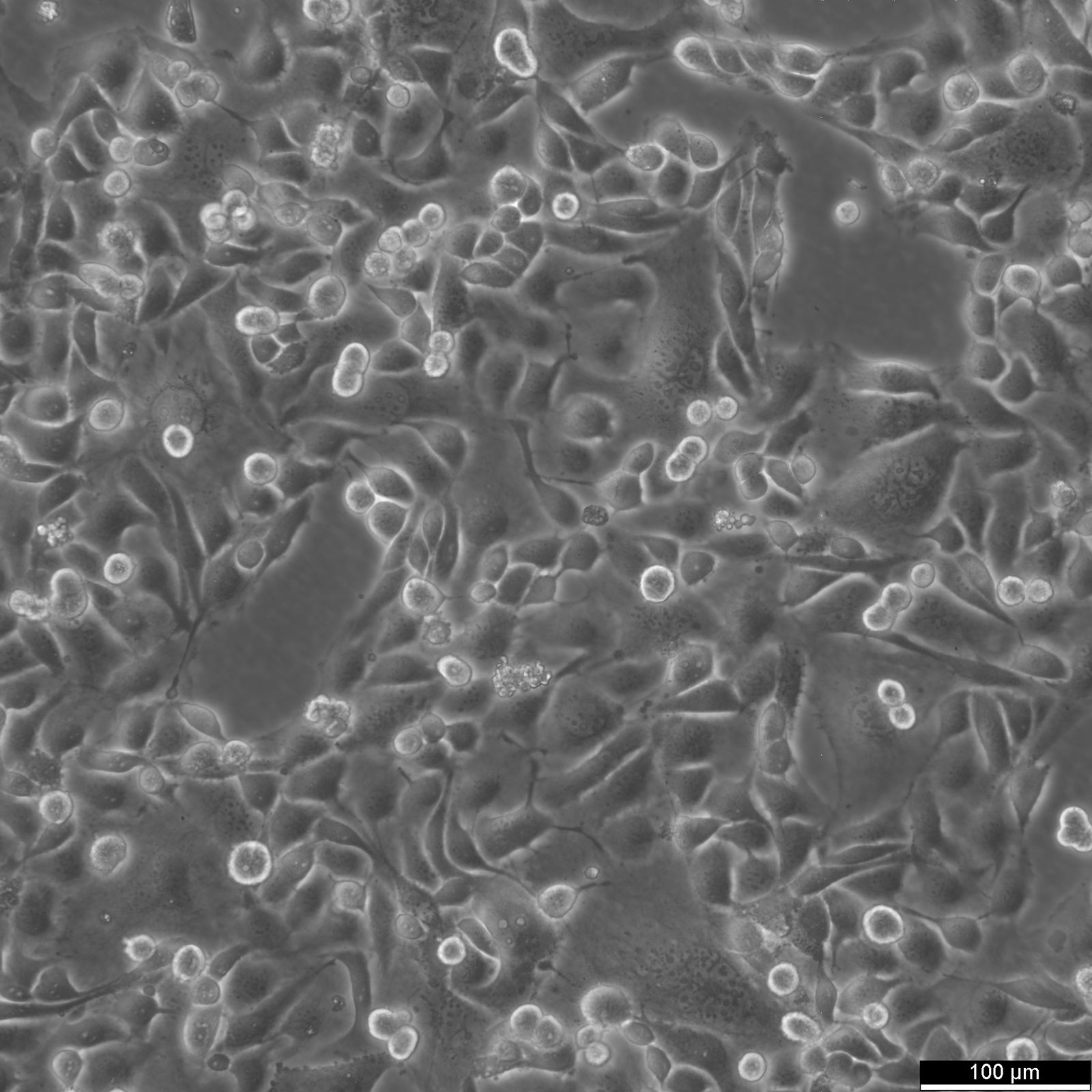 AnglneCells