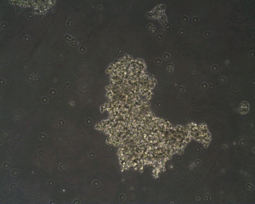 NCI-H209 Cells