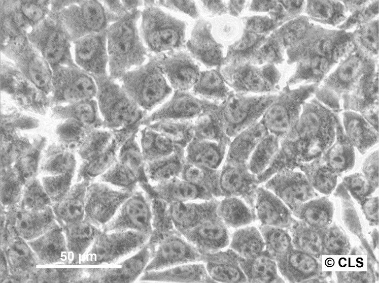 RenCa Cells RenCa Cells