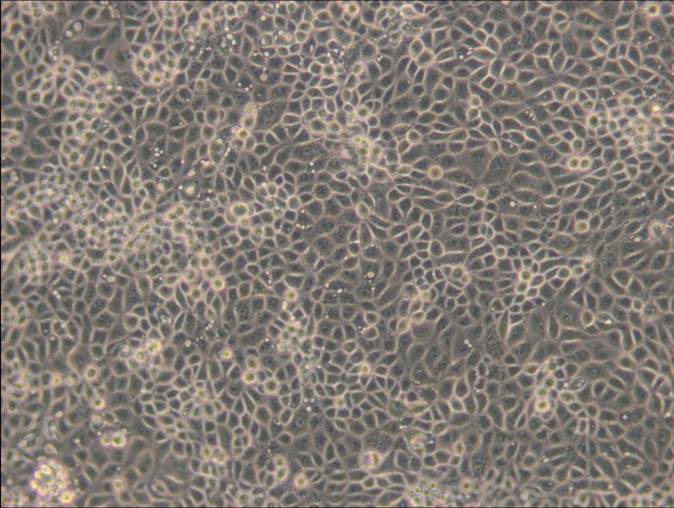 ST-Zellen