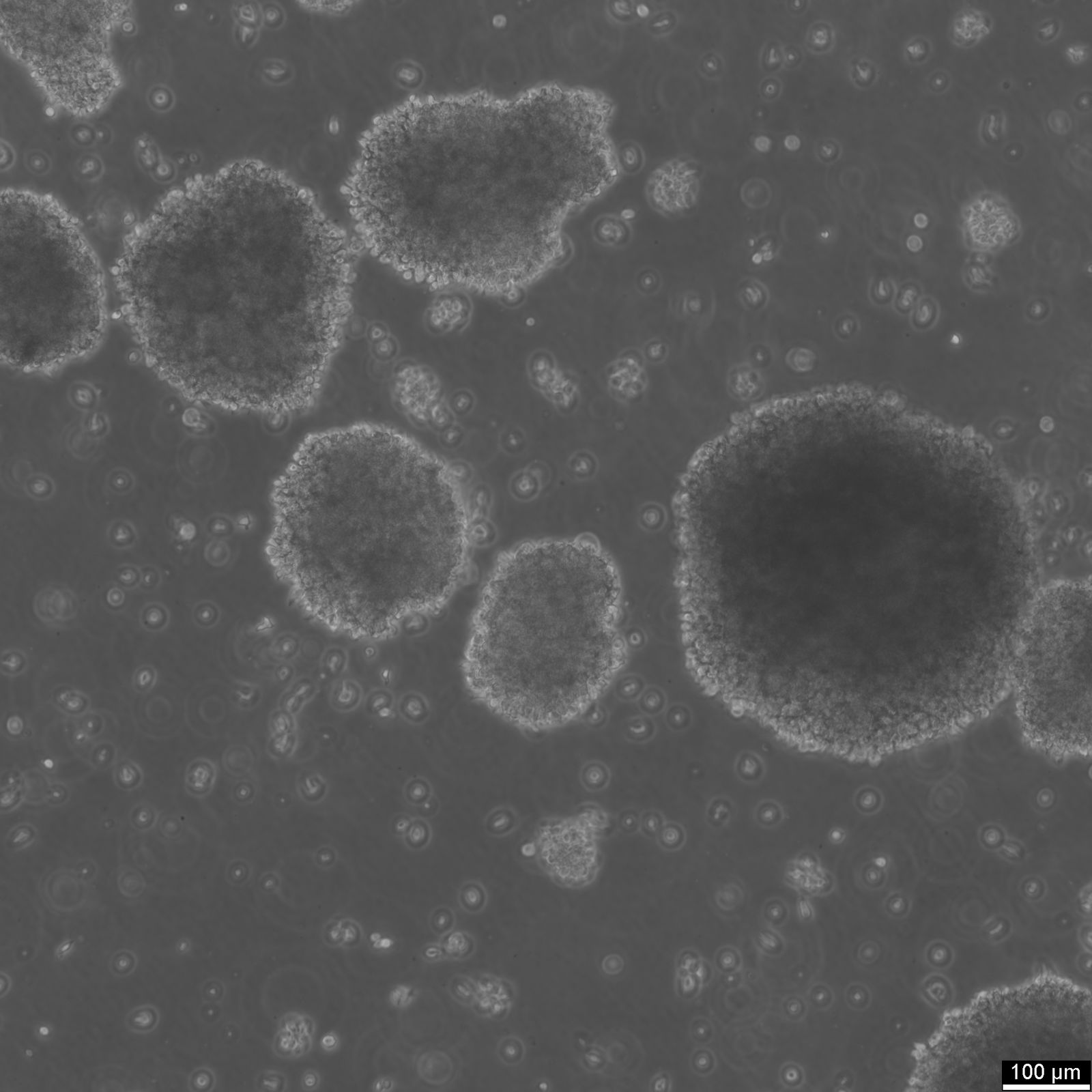 B-LCL-HROC69 Cells B-LCL-HROC69 Cells