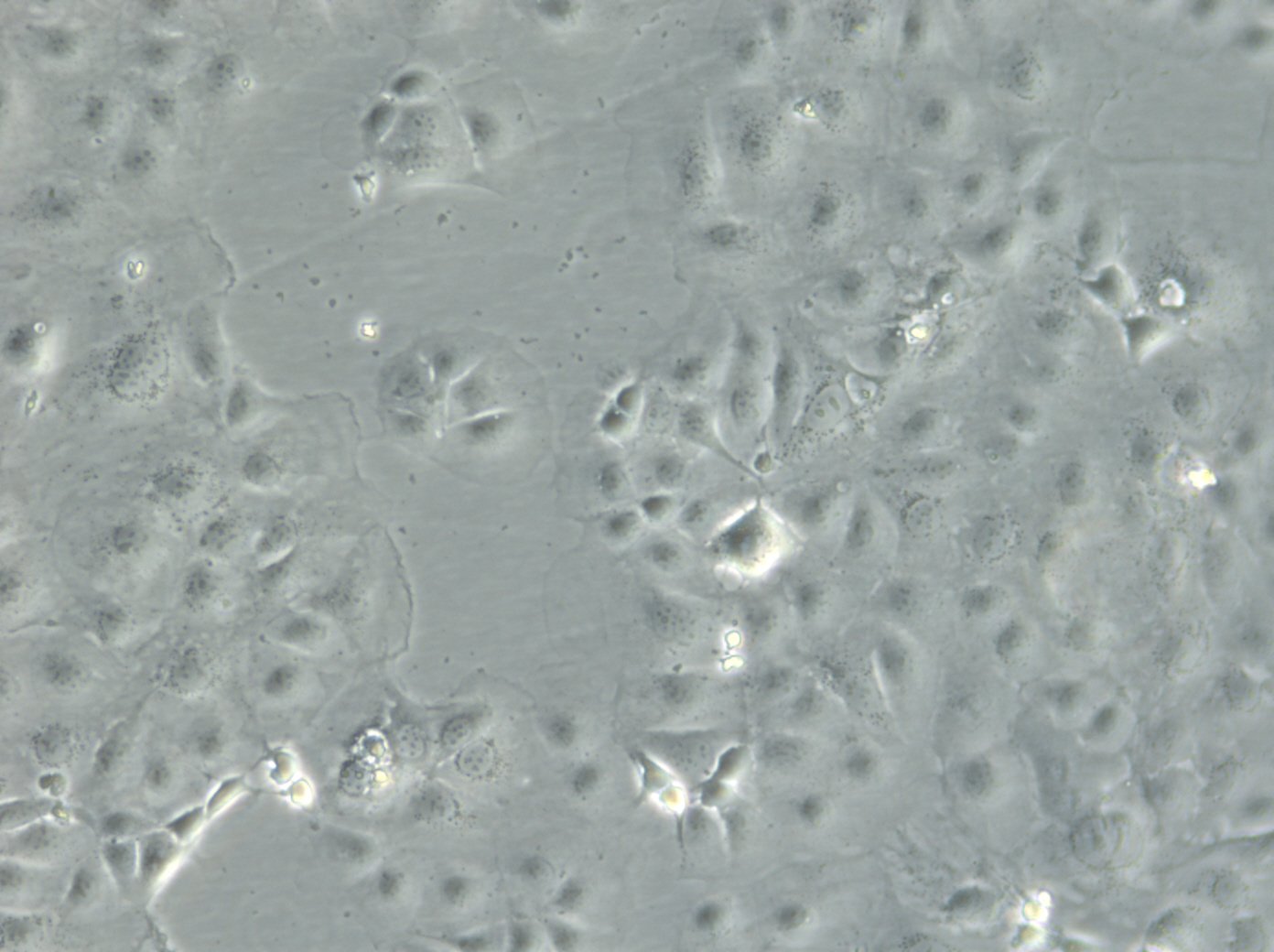 Cellules Caco-2