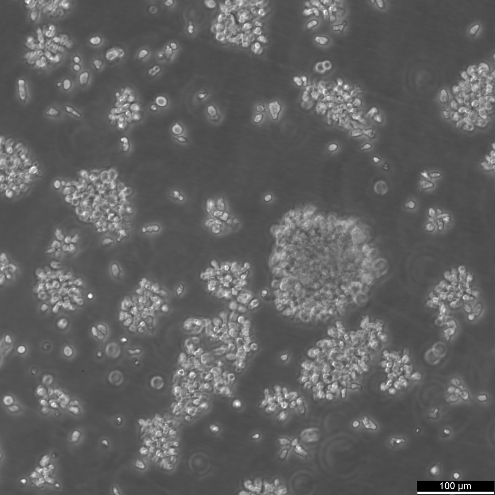 B-LCL-HROC69 Cells B-LCL-HROC69 Cells