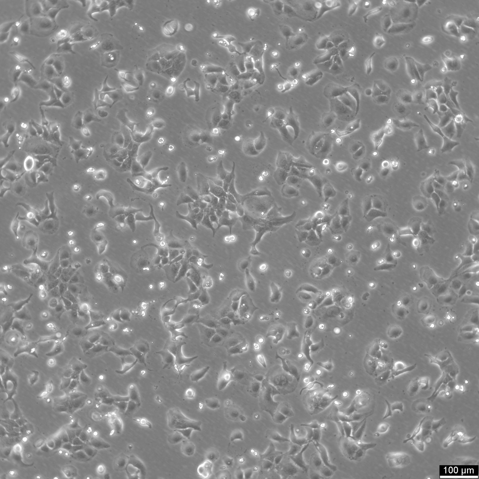BT-20 Cells