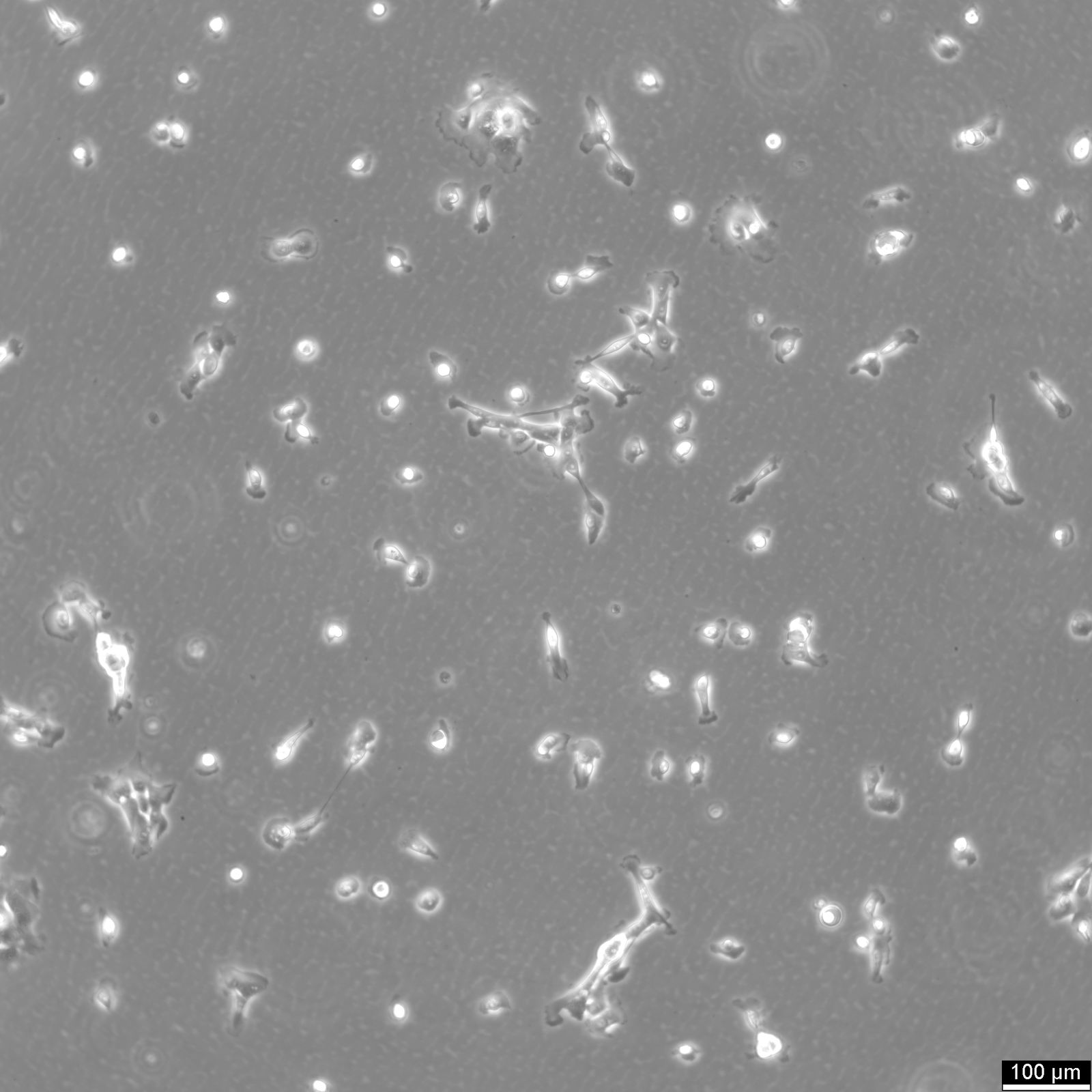 MCF10A Cells