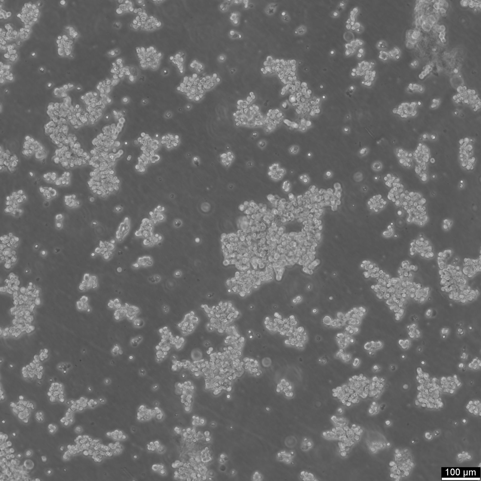 DMS-79 Cells DMS-79 Cells