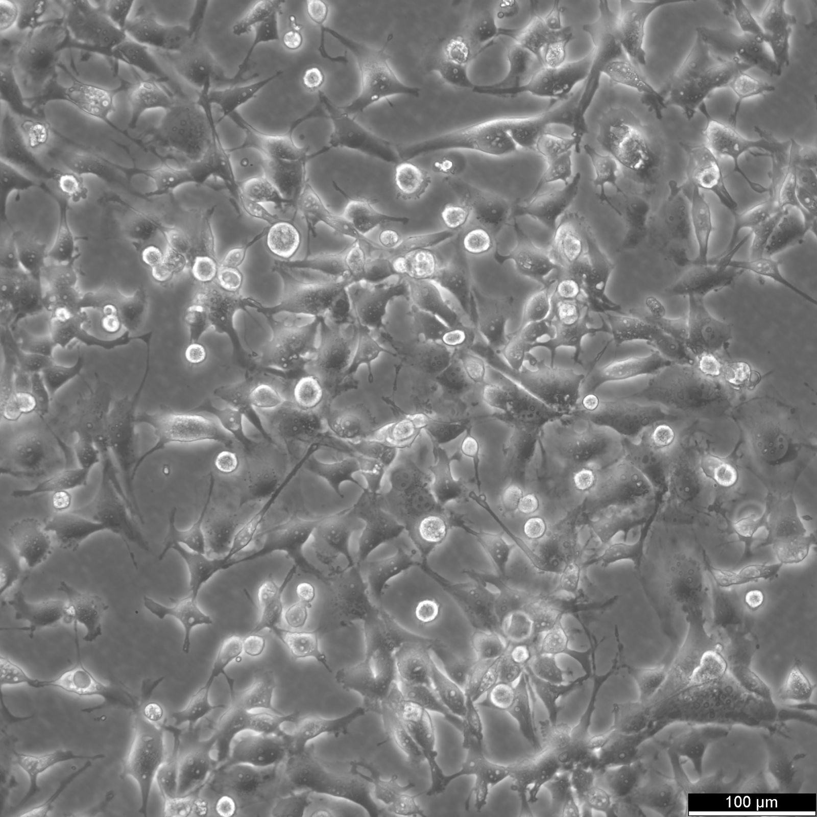 MDA-MB-436 Cells MDA-MB-436 Cells