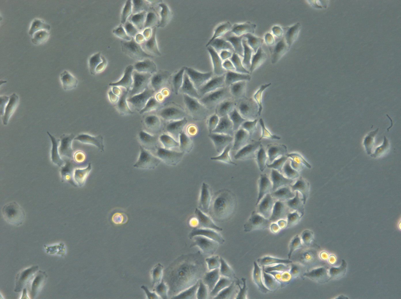 HK EGFP-LaminB1/H2B-mCherry-Zellen