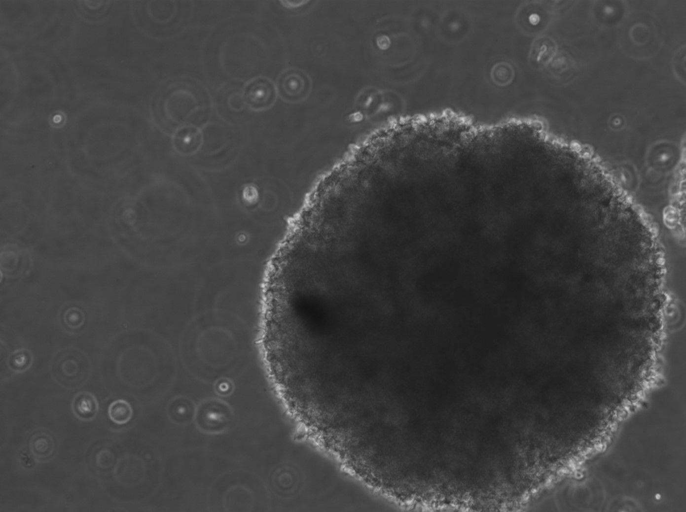 B-LCL-HROC75 Cells B-LCL-HROC75 Cells