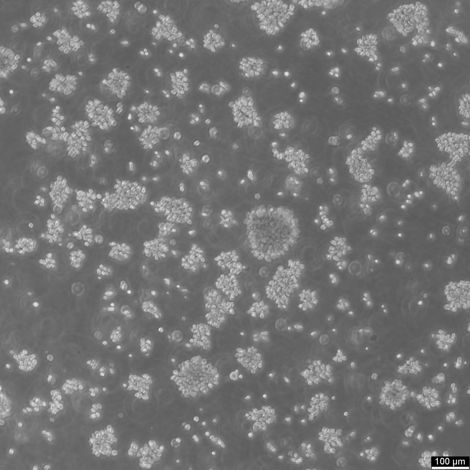 B-LCL-HROC69 Cells B-LCL-HROC69 Cells