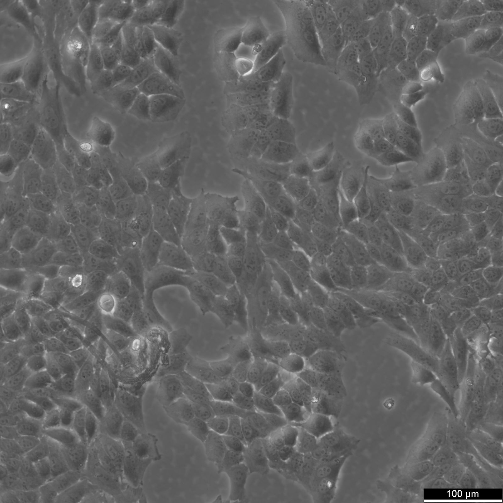 Hela 229 Cells Hela 229 Cells