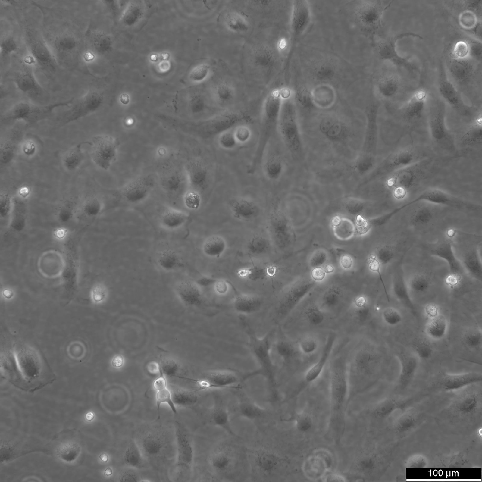 MARC-145 Cells MARC-145 Cells