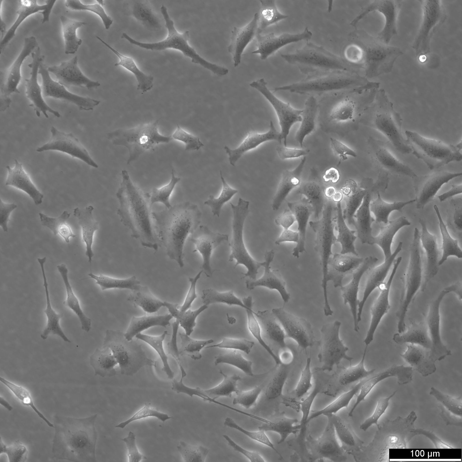 HEp-2 Cells HEp-2 Cells
