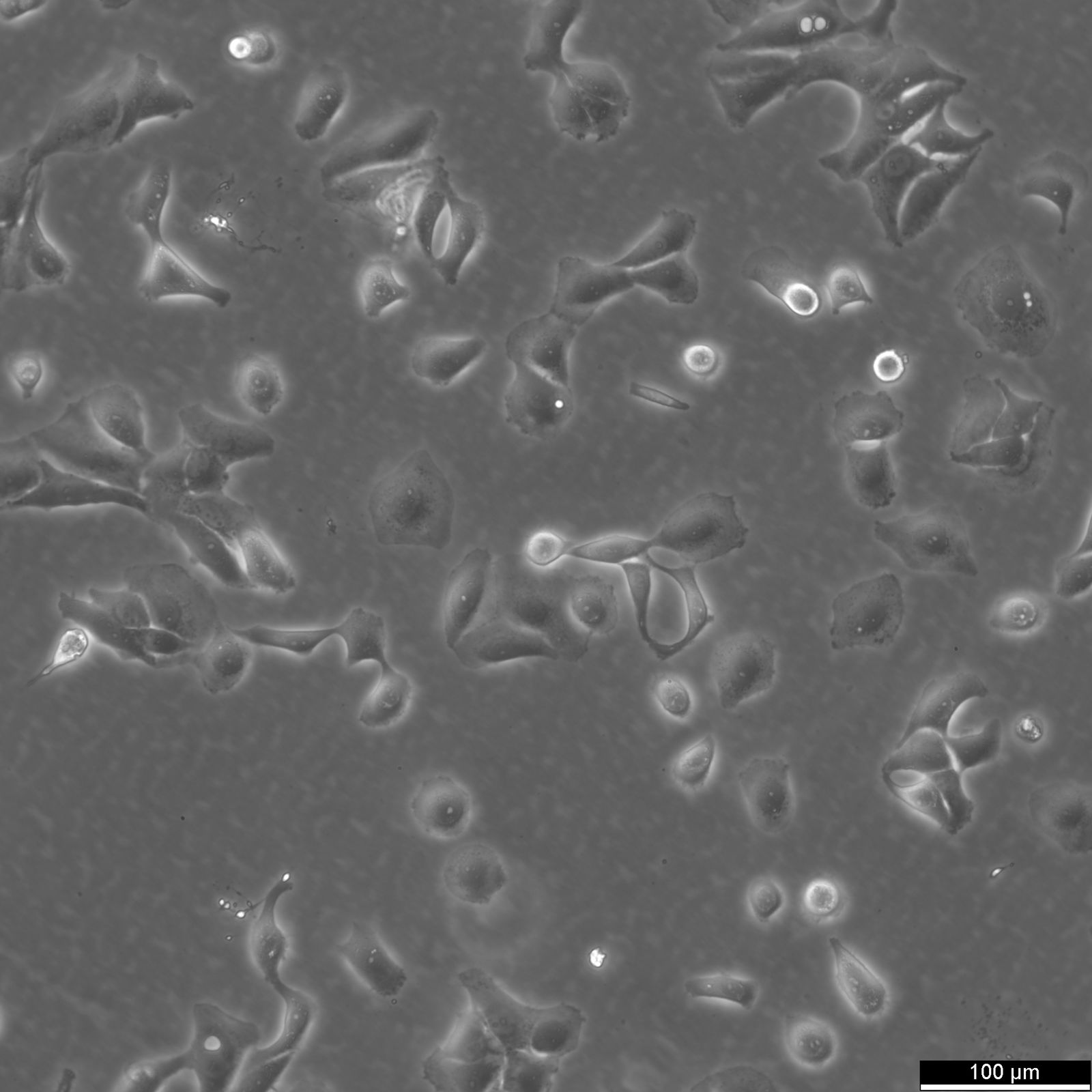 BT-20 Cells