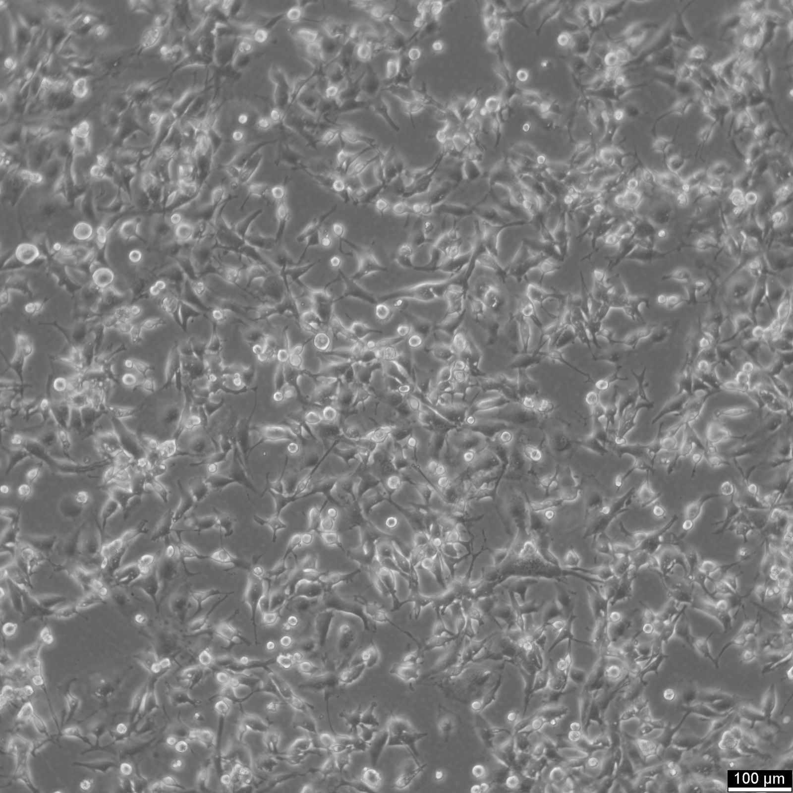 MDA-MB-436 Cells MDA-MB-436 Cells