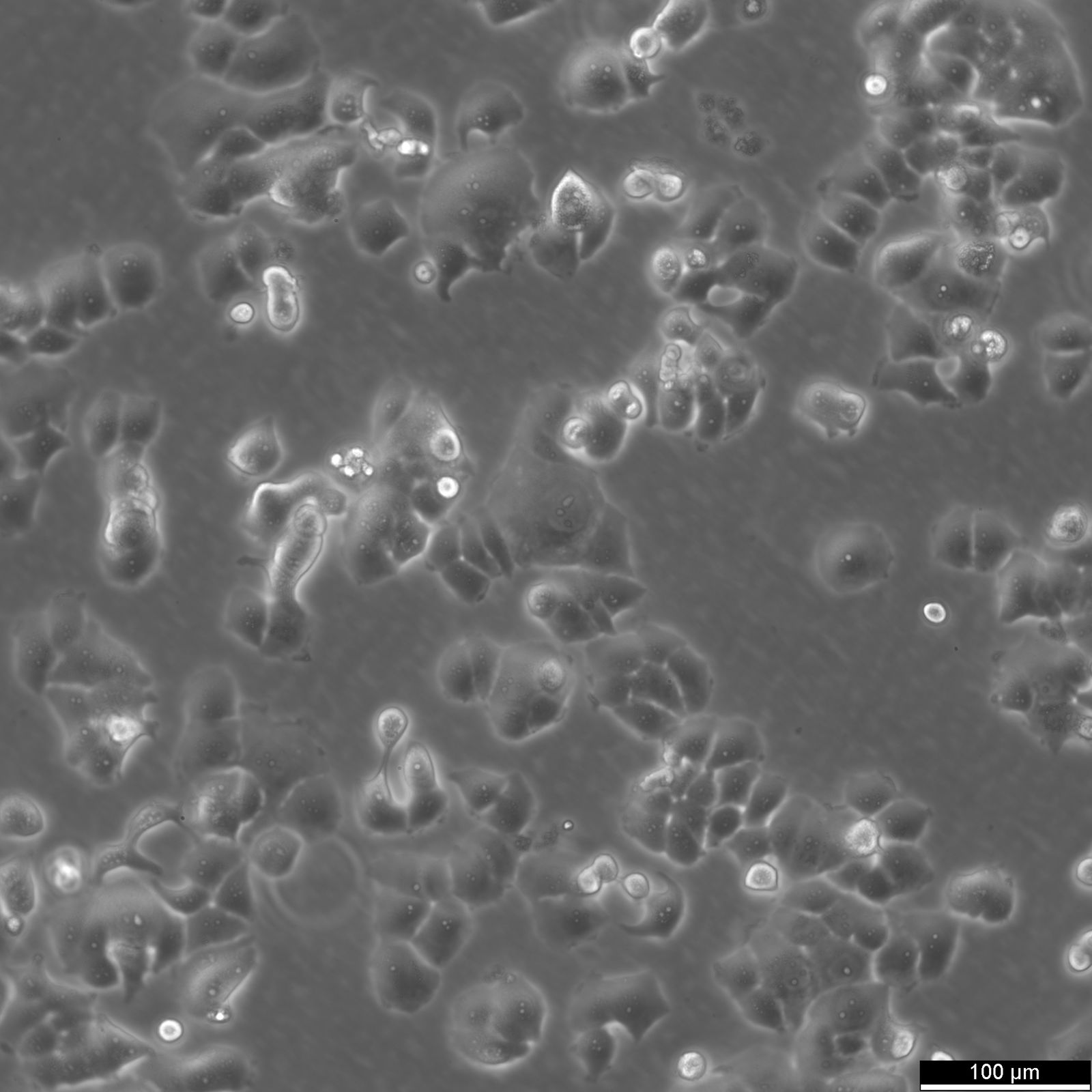 T47D Cells T47D Cells