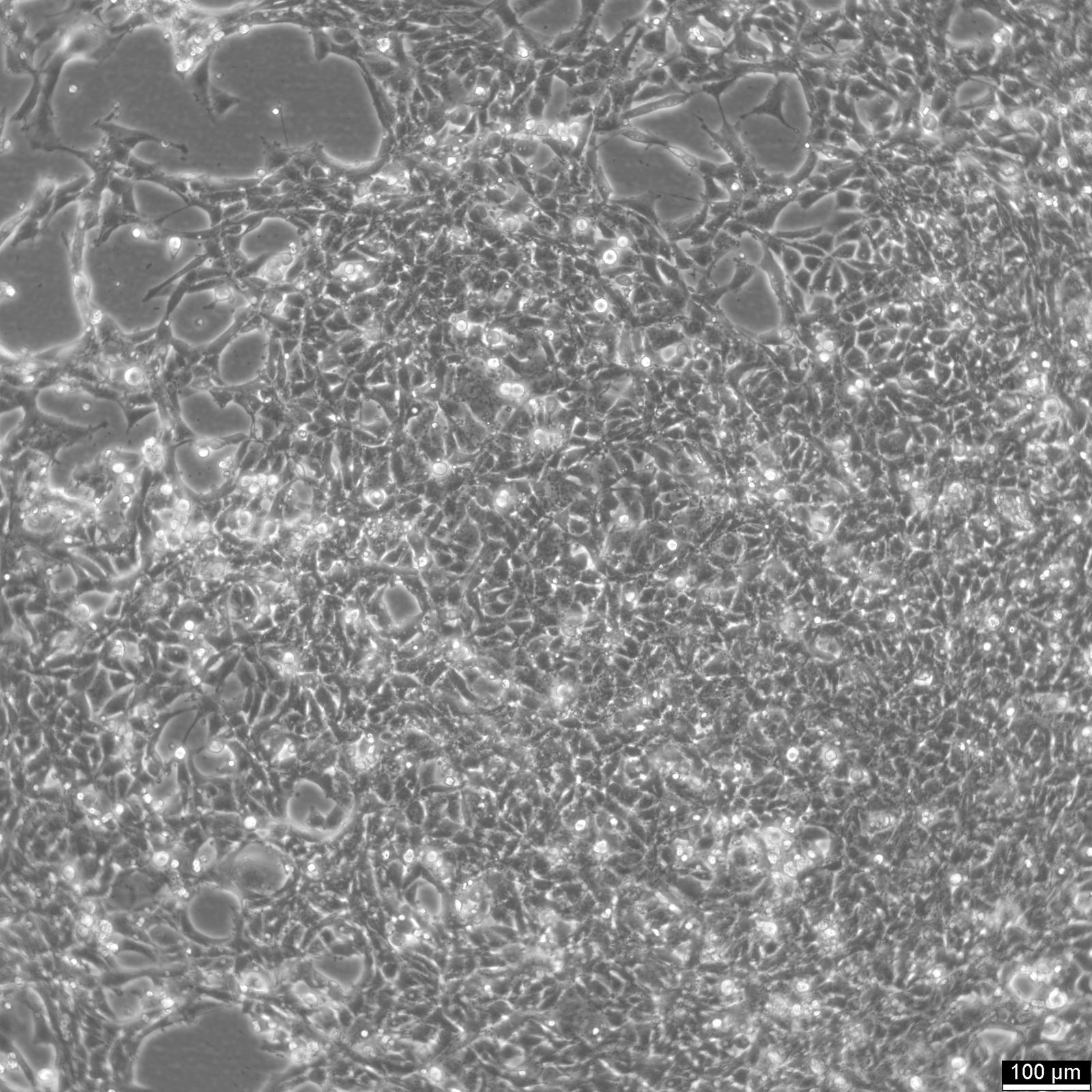 NCI-H446 Cells