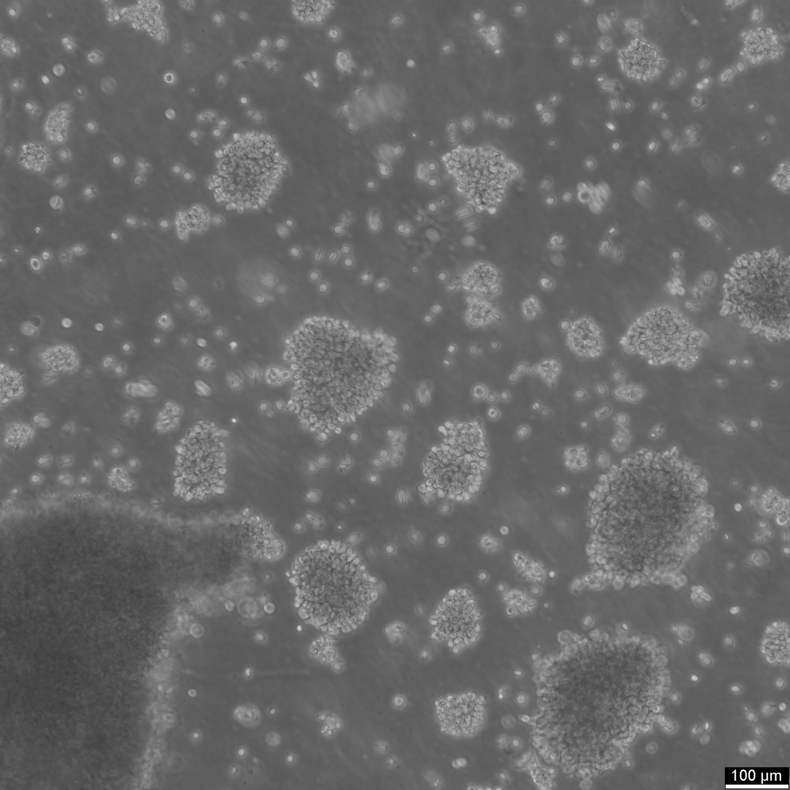 B-LCL-HROC69 Cells B-LCL-HROC69 Cells