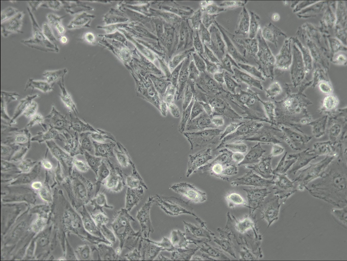 IBRS-2-Zellen