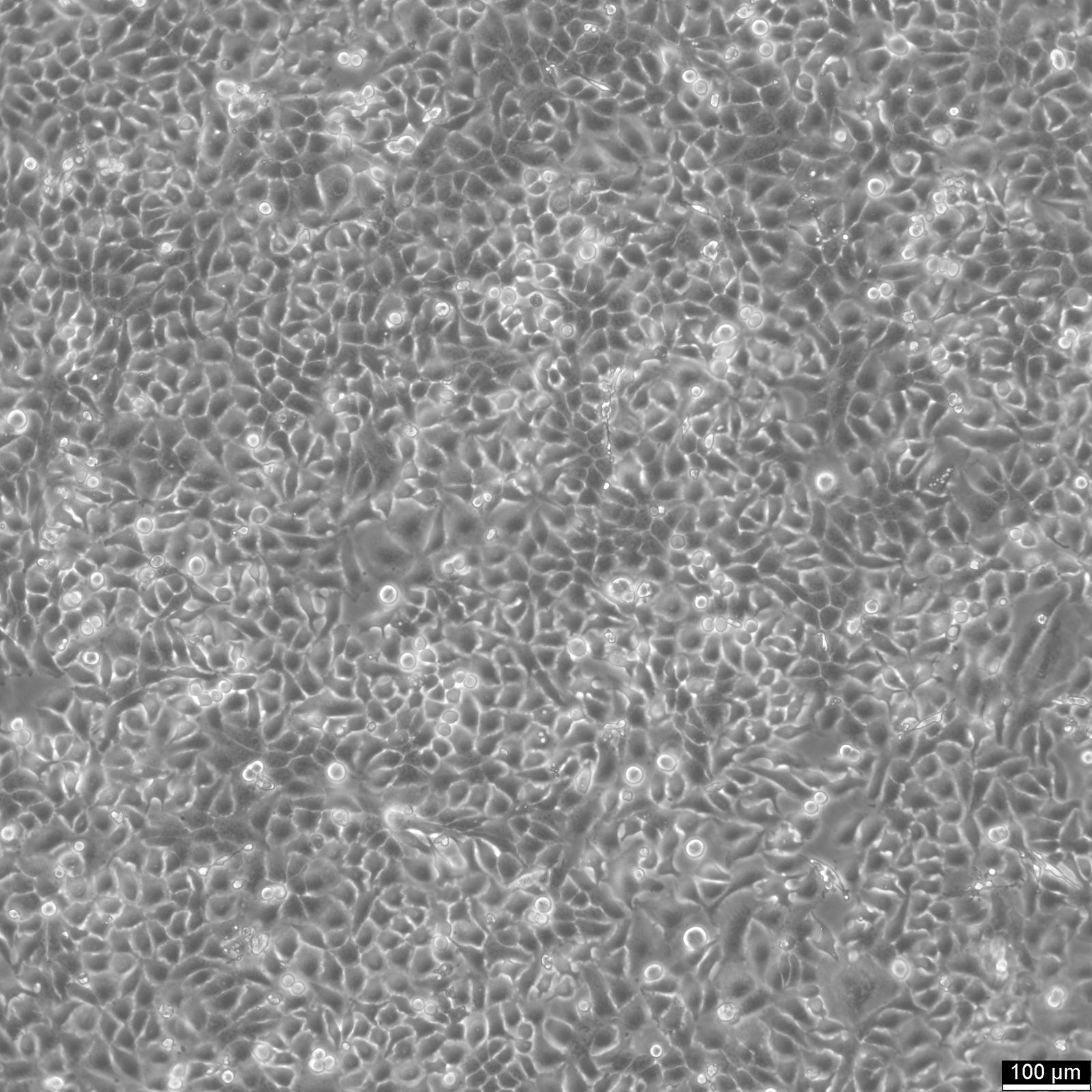 RT-112 Cells RT-112 Cells