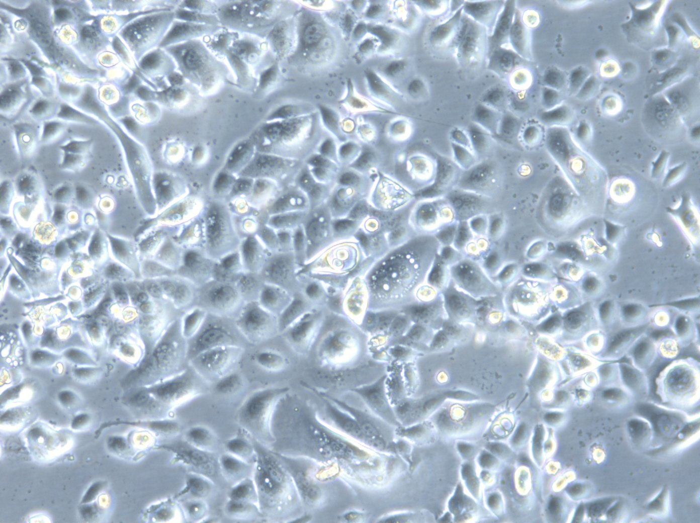 HROC173 Cells