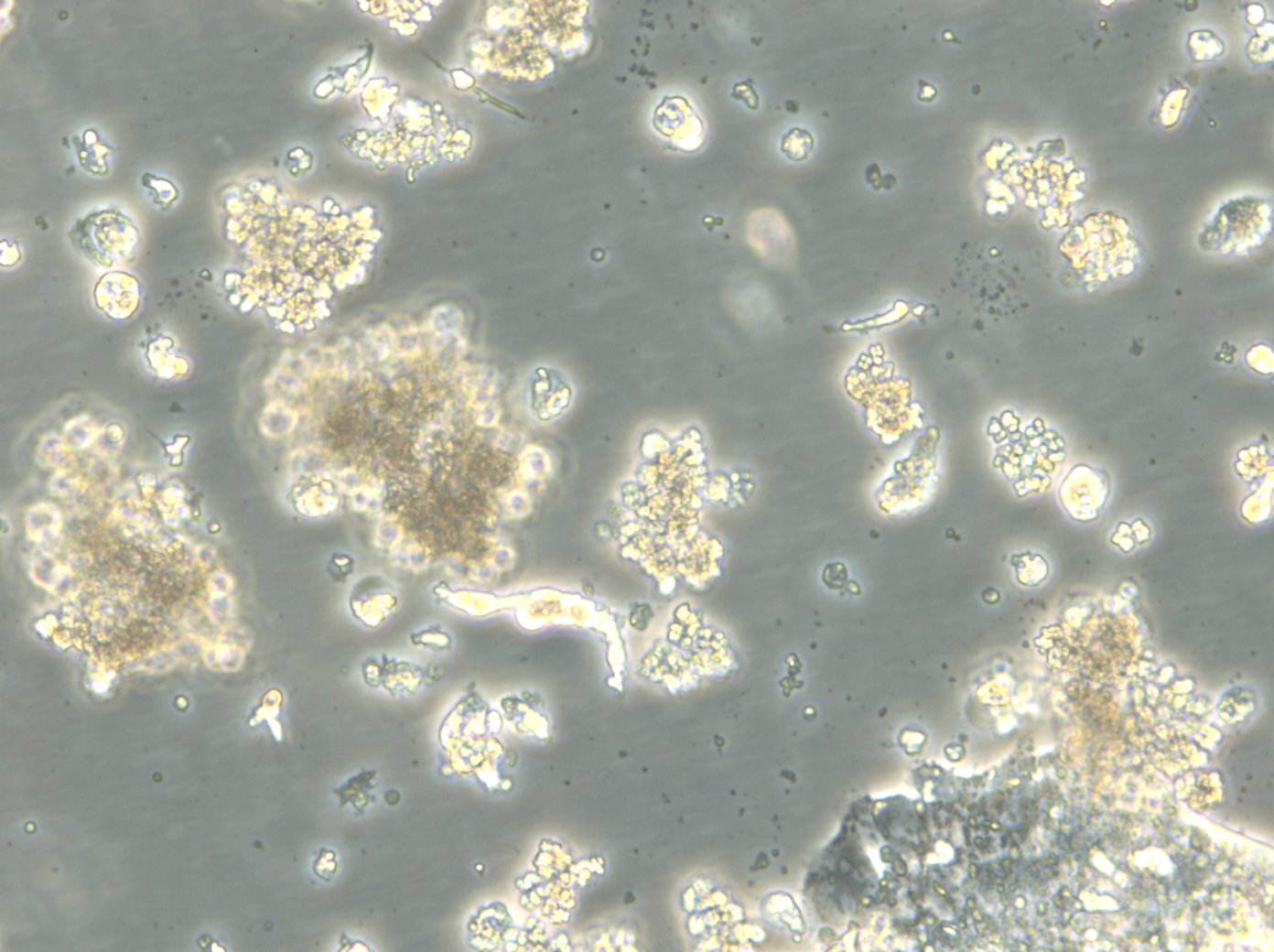 HROC59 T1 M1-Zellen