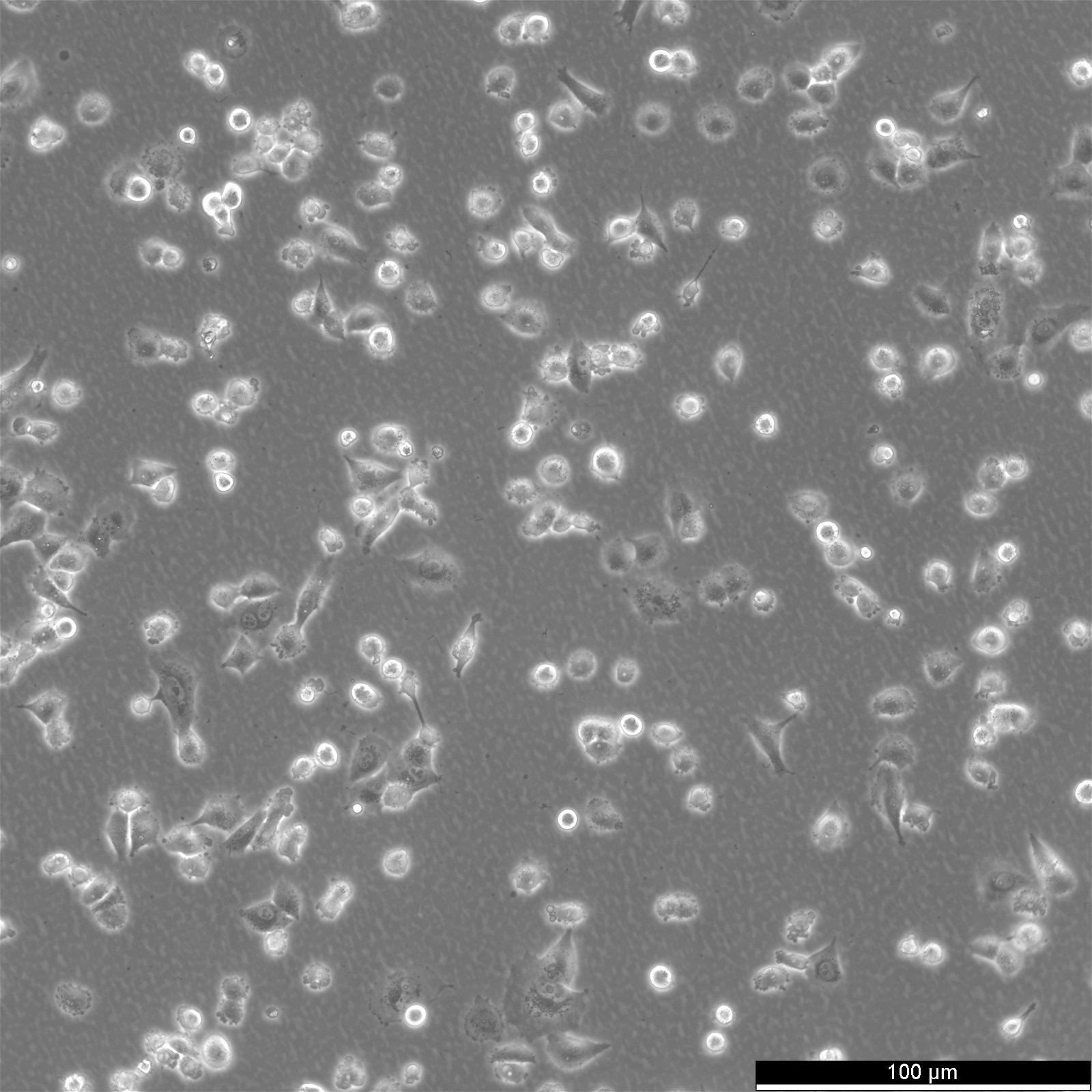 Cellules NCI-H1299-EGFP
