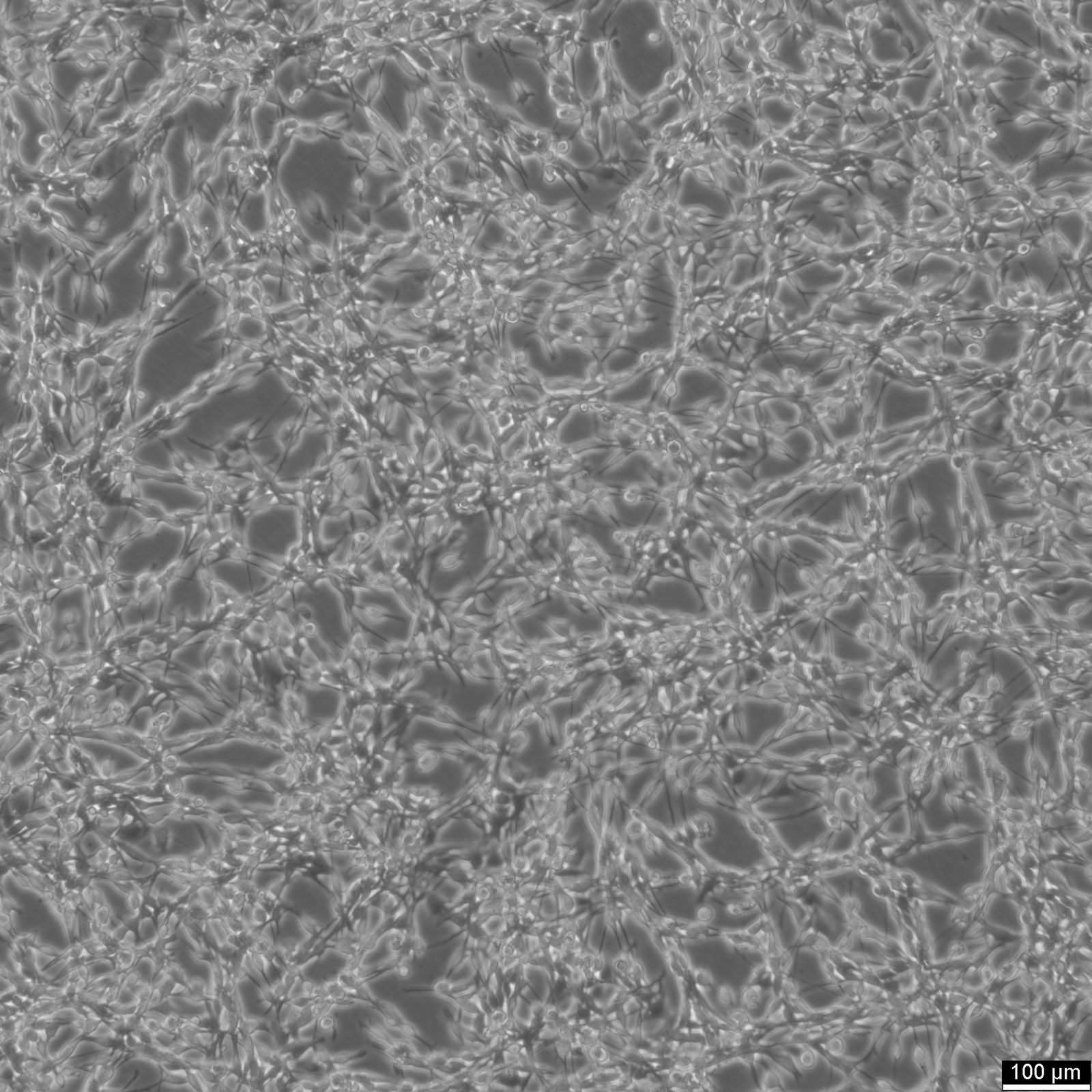 Cellules CT26 Cellules CT26