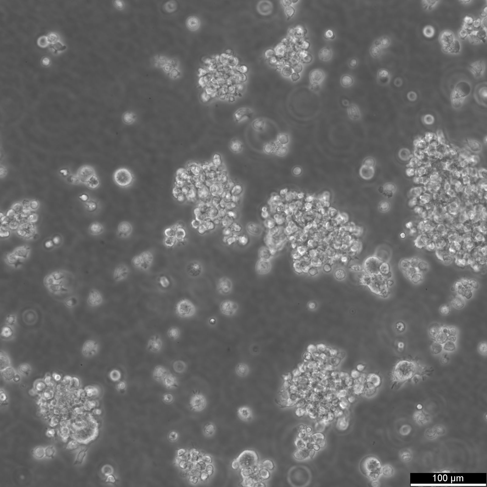 EB1 Cells