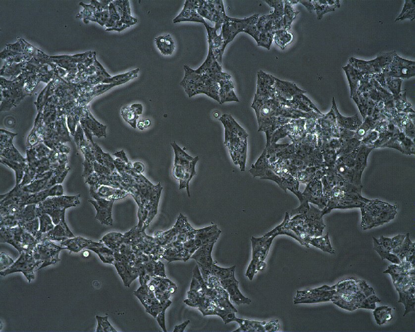 NCI-H295R-Zellen
