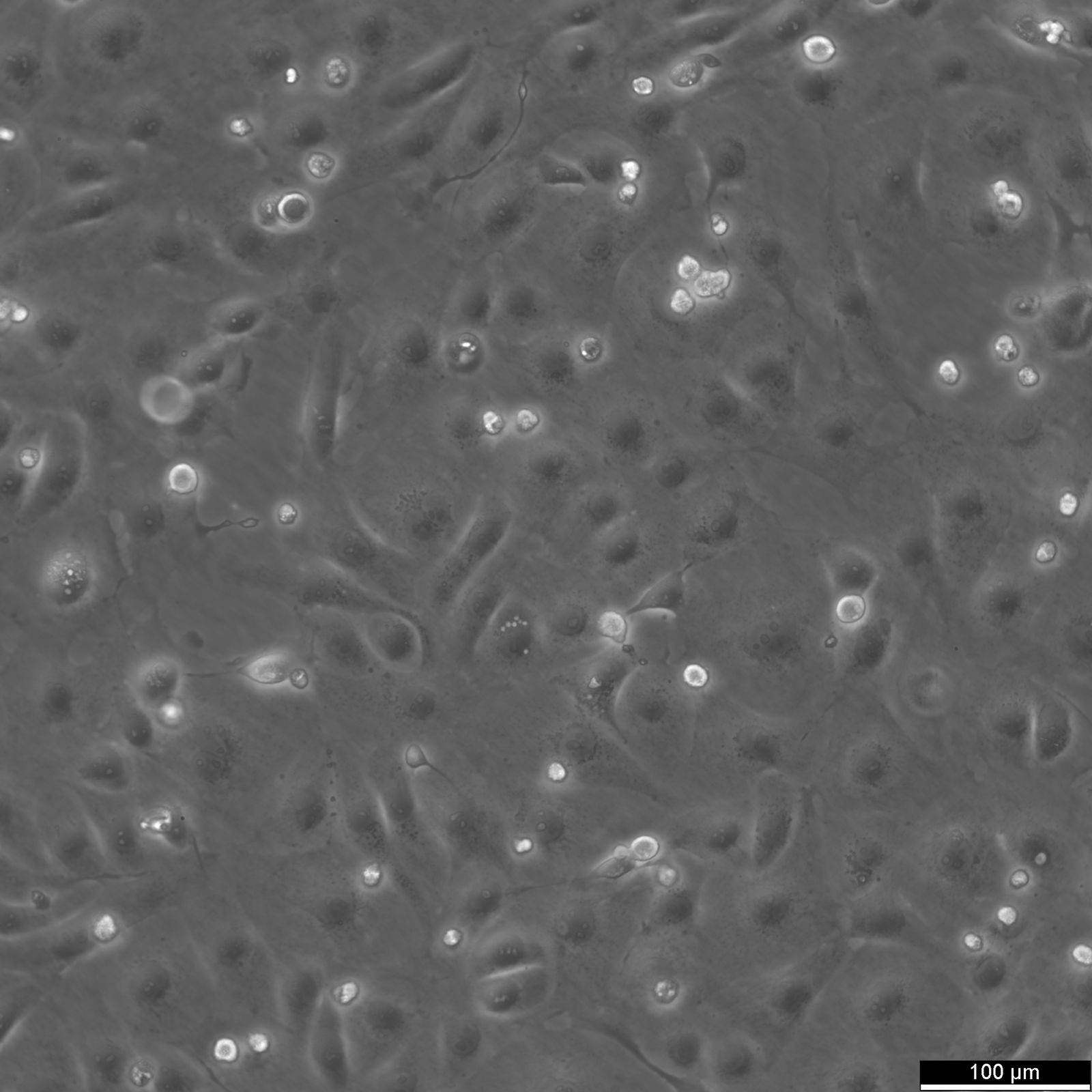 MARC-145 Cells MARC-145 Cells