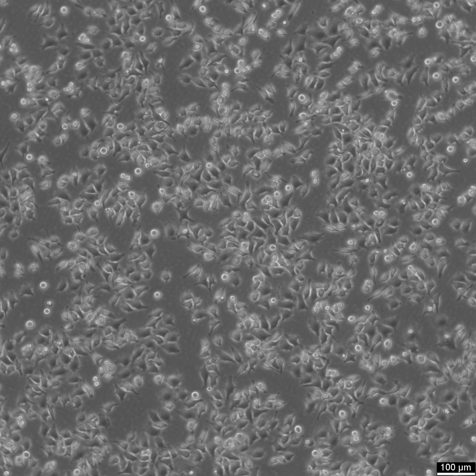 HK-CRISPR-mEGFP-Nup214-Zellen HK-CRISPR-mEGFP-Nup214-Zellen