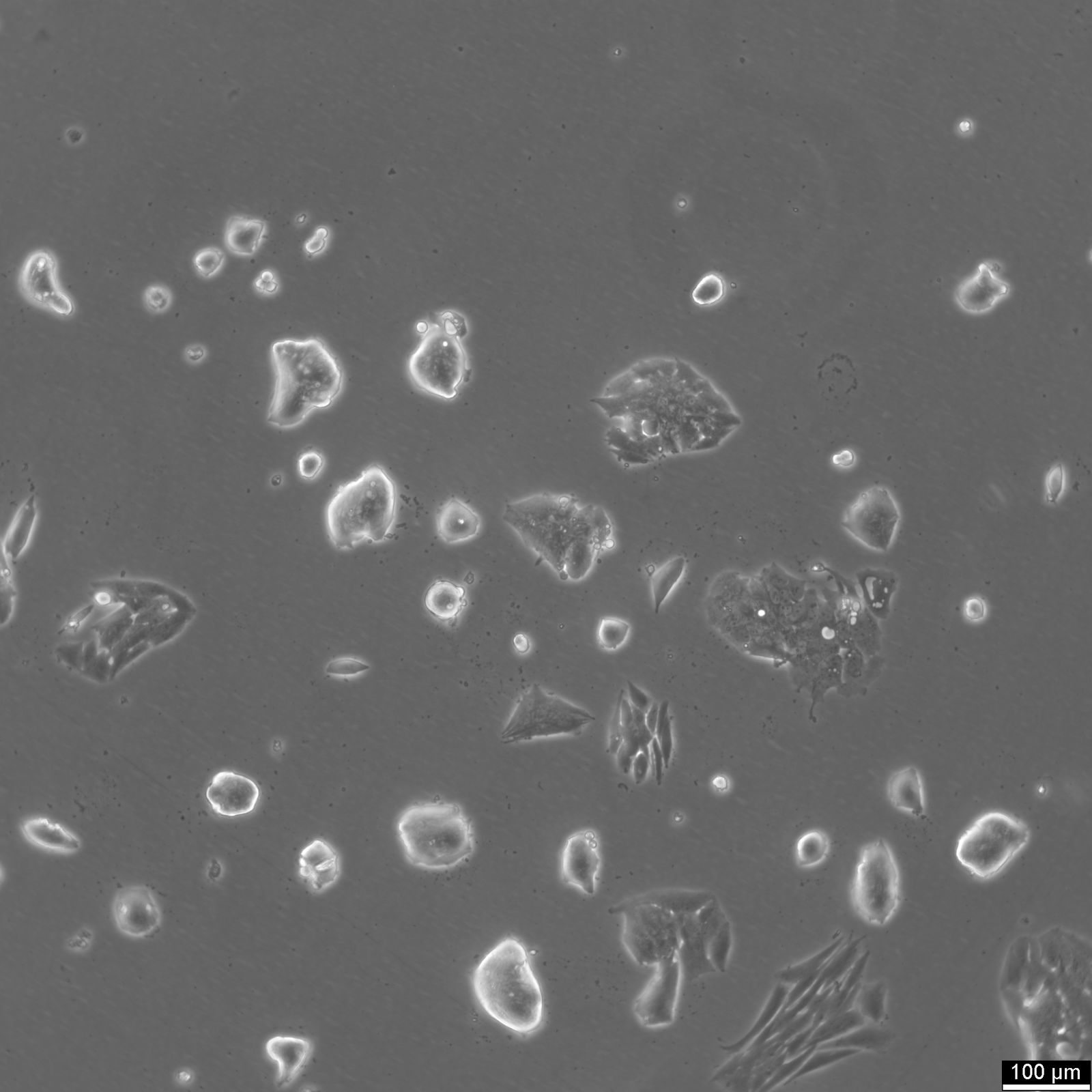 NCI-H2195 Cells