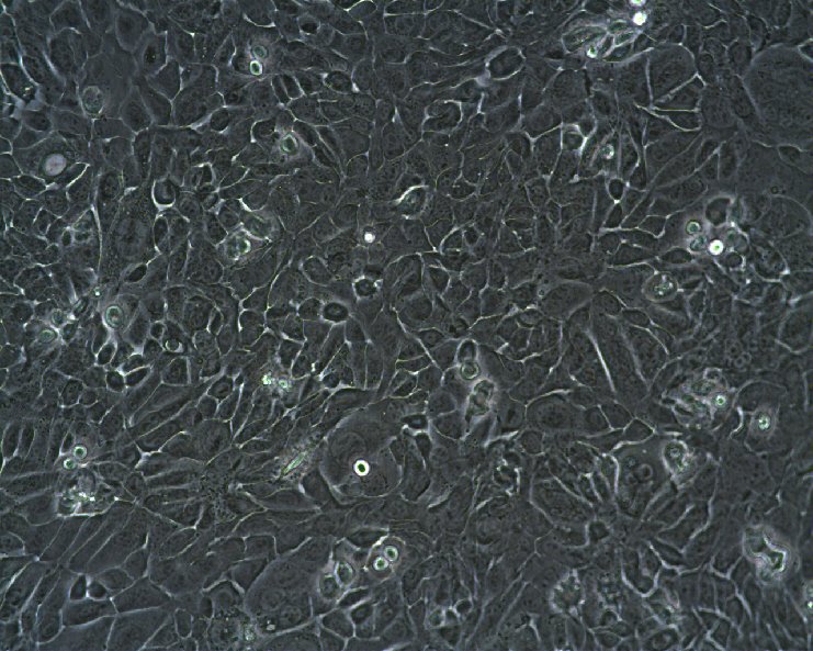 PDV Cells