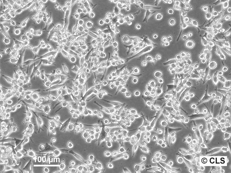 SK-MEL-5 Cells