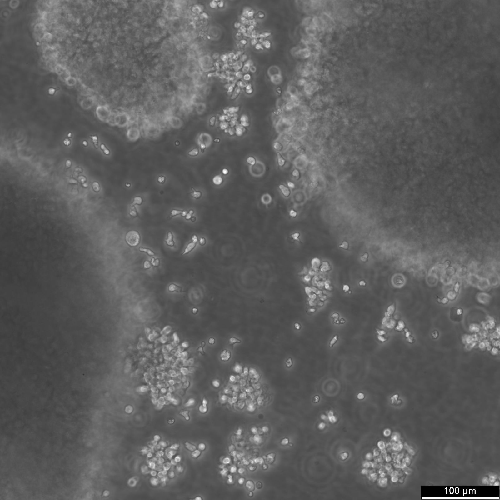 B-LCL-HROC69 Cells B-LCL-HROC69 Cells