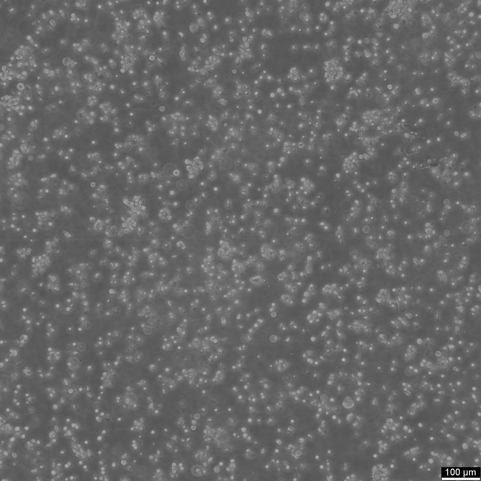 B-LCL-HROC69 Cells B-LCL-HROC69 Cells